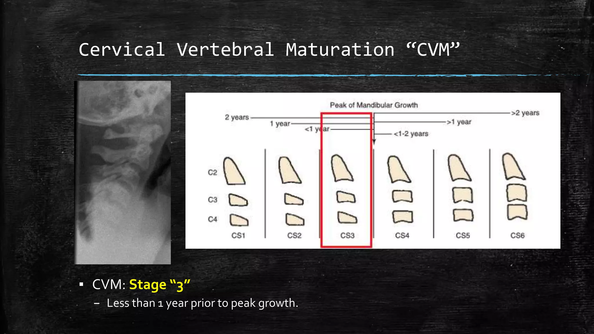 Orthodontic clinical case presentation - Dr shareef alshanableh | PPTX