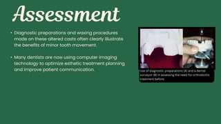 • Diagnostic preparations and waxing procedures
made on these altered casts often clearly illustrate
the benefits of minor tooth movement.
• Many dentists are now using computer imaging
technology to optimize esthetic treatment planning
and improve patient communication. Use of diagnostic preparations (A) and a dental
surveyor (B) in assessing the need for orthodontic
treatment before
 