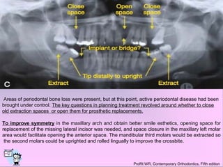 Orthodontic consideration of the old extraction site | PPT