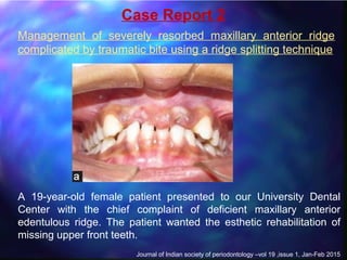 Split Ridge Maxilla Orthodontic consideration of the old extraction site | PPT