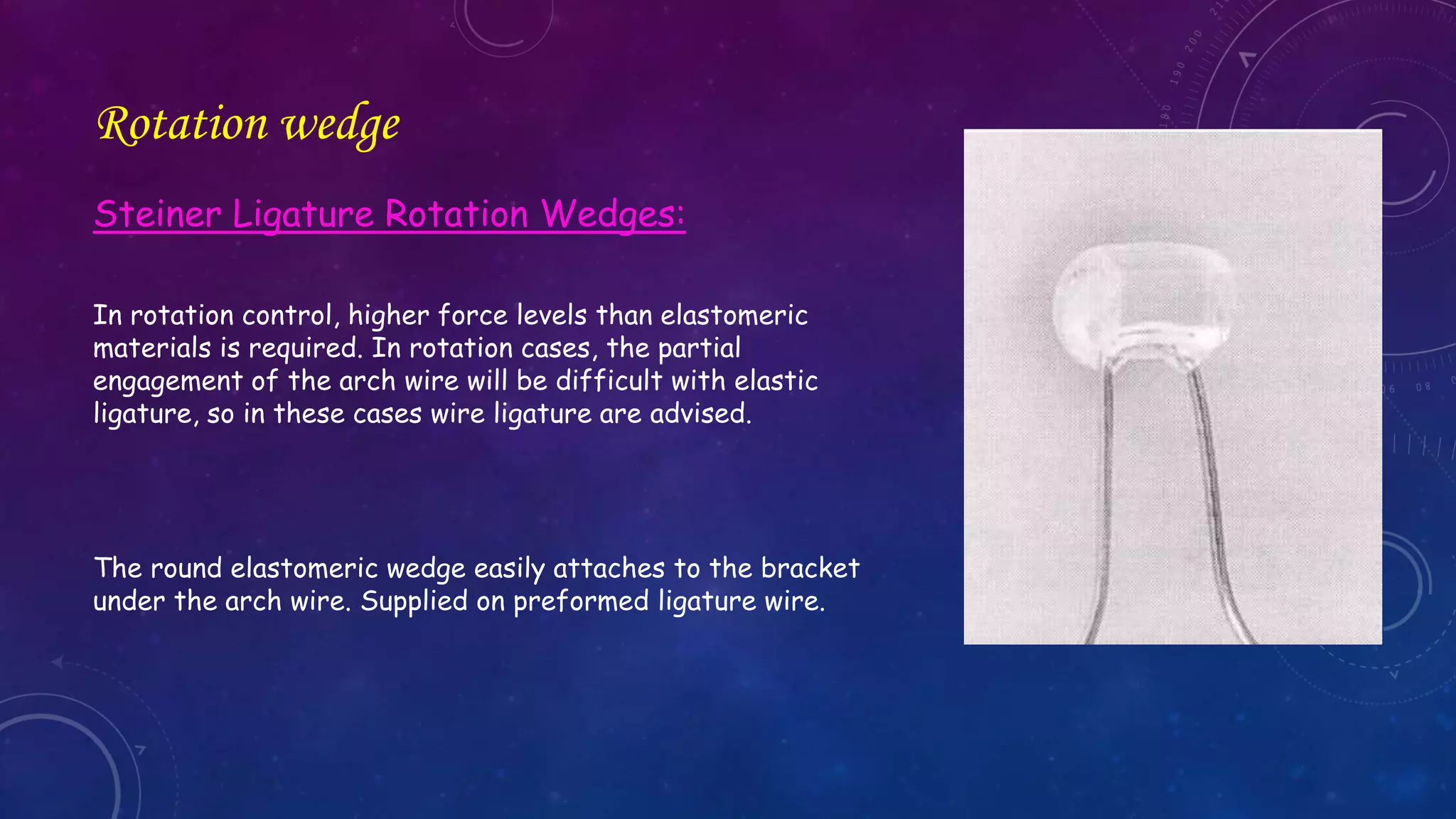 External Rotation Wedge Orthodontic Correction of Rotated Teeth | PPTX