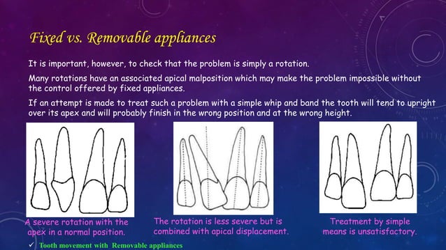 Orthodontic Correction of Rotated Teeth | PPTX | Dental Health ...