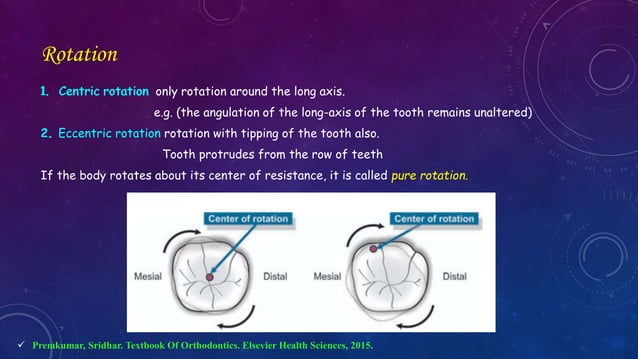 Dental Rotation Orthodontic Correction of Rotated Teeth | PPTX | Dental Health ...