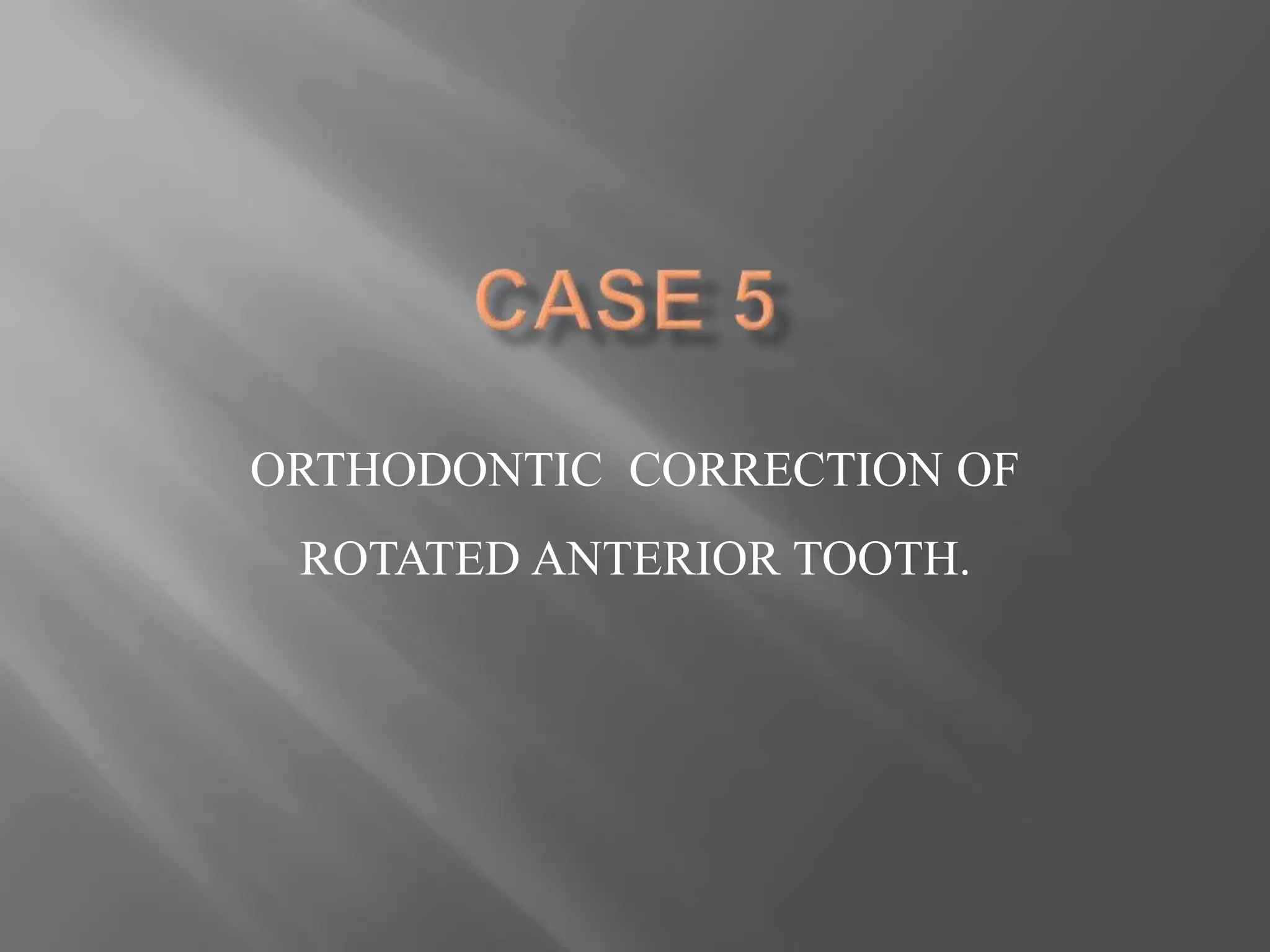 ORTHODONTIC CORRECTION OF
ROTATED ANTERIOR TOOTH.