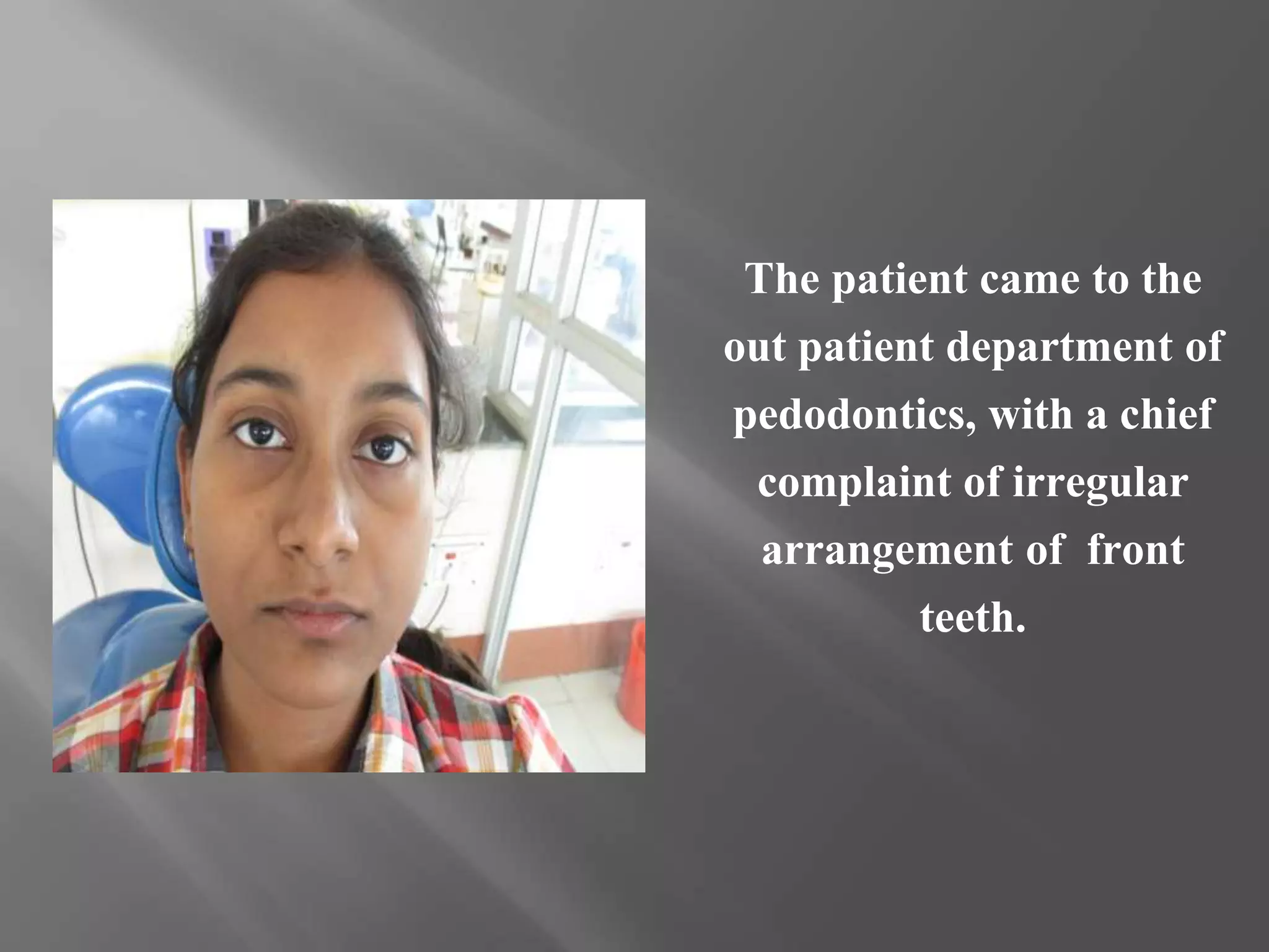 The patient came to the
out patient department of
pedodontics, with a chief
complaint of irregular
arrangement of front
teeth.