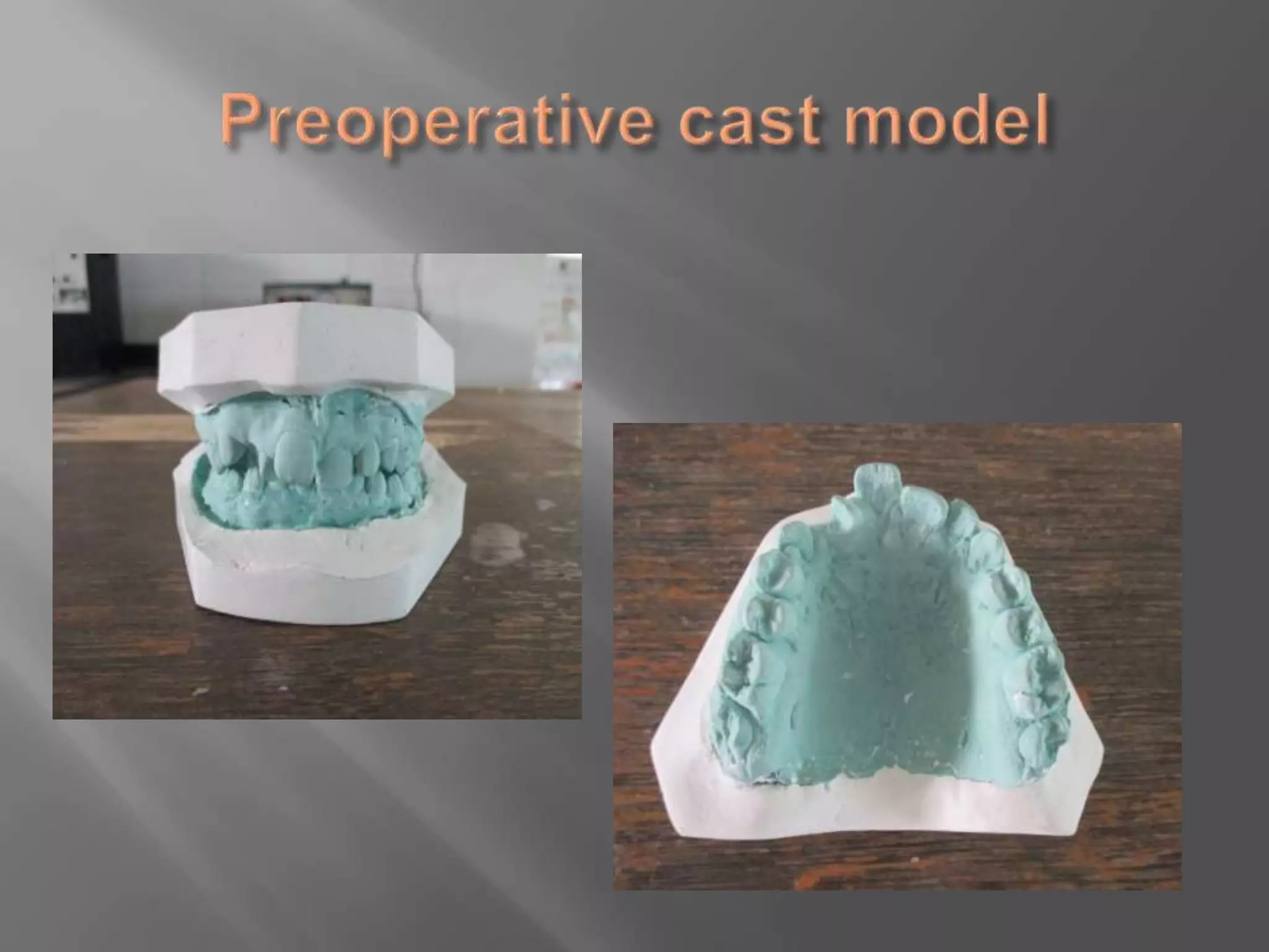 Orthodontic correction of rotated tooth