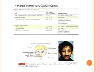 principal stages in craniofacial development :-
13
 