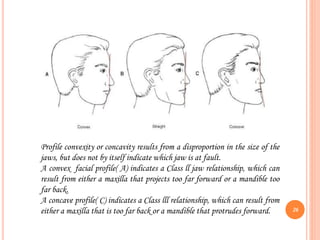 Profile convexity or concavity results from a disproportion in the size of the
jaws, but does not by itself indicate which jaw is at fault.
A convex facial profile( A) indicates a Class ll jaw relationship, which can
result from either a maxilla that projects too far forward or a mandible too
far back.
A concave profile( C) indicates a Class lll relationship, which can result from
either a maxilla that is too far back or a mandible that protrudes forward. 26
 