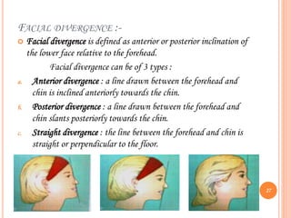 FACIAL DIVERGENCE :-
 Facial divergence is defined as anterior or posterior inclination of
the lower face relative to the forehead.
Facial divergence can be of 3 types :
a. Anterior divergence : a line drawn between the forehead and
chin is inclined anteriorly towards the chin.
b. Posterior divergence : a line drawn between the forehead and
chin slants posteriorly towards the chin.
c. Straight divergence : the line between the forehead and chin is
straight or perpendicular to the floor.
27
 