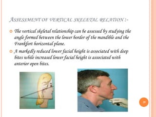 ASSESSMENT OF VERTICAL SKELETAL RELATION :-
 The vertical skeletal relationship can be assessed by studying the
angle formed between the lower border of the mandible and the
Frankfort horizontal plane.
 A markedly reduced lower facial height is associated with deep
bites while increased lower facial height is associated with
anterior open bites.
29
 
