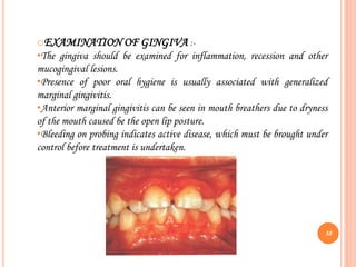oEXAMINATION OF GINGIVA :-
•The gingiva should be examined for inflammation, recession and other
mucogingival lesions.
•Presence of poor oral hygiene is usually associated with generalized
marginal gingivitis.
•Anterior marginal gingivitis can be seen in mouth breathers due to dryness
of the mouth caused be the open lip posture.
•Bleeding on probing indicates active disease, which must be brought under
control before treatment is undertaken.
38
 