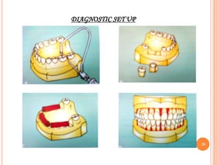 DIAGNOSTIC SET UP
56
 