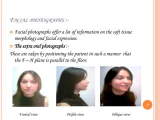 FACIAL PHOTOGRAPHS :-
 Facial photographs offer a lot of information on the soft tissue
morphology and facial expression.
 The extra oral photographs :-
These are taken by positioning the patient in such a manner that
the F – H plane is parallel to the floor.
Frontal view Profile view Oblique view
57
 
