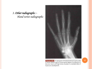 3. Other radiographs :-
Hand wrist radiographs
63
 