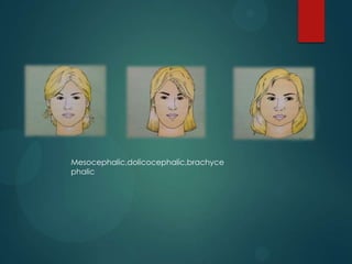 Mesocephalic,dolicocephalic,brachyce
phalic
 