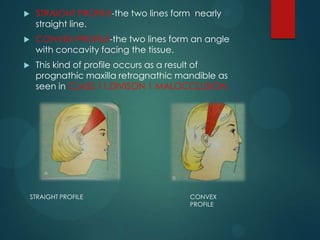  STRAIGHT PROFILE-the two lines form nearly
straight line.
 CONVEX PROFILE-the two lines form an angle
with concavity facing the tissue.
 This kind of profile occurs as a result of
prognathic maxilla retrognathic mandible as
seen in CLASS 11,DIVISON 1 MALOCCLUSION.
STRAIGHT PROFILE CONVEX
PROFILE
 