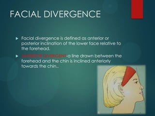 FACIAL DIVERGENCE
 Facial divergence is defined as anterior or
posterior inclination of the lower face relative to
the forehead.
 ANTERIOR DIVERGENT-a line drawn between the
forehead and the chin is inclined anteriorly
towards the chin..
 