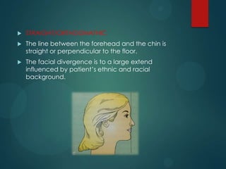  STRAIGHT/ORTHOGNATHIC
 The line between the forehead and the chin is
straight or perpendicular to the floor.
 The facial divergence is to a large extend
influenced by patient’s ethnic and racial
background.
 