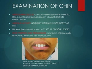EXAMINATION OF CHIN
 MENTOLABIAL SULCUS-concavity seen below the lower lip.
Deep mentolabial sulcus is seen in CLASS11,DIVISON 1
malocclusion.
 MENTALIS ACTIVITY-NORMALY MENTALIS IS NOT ACTIVE AT
REST.
 Hyperactive mentalis is seen in CLASS 11 DIVISON 1 CASES.
 CHIN POSITION AND PROMINENCE-prominent chin is usually
associated with class 111 malocclusion.
DEEP MENTOLABIAL SULCUS AND
HYPERACTIVE MENTALIS SEEN IN CLASS 11
DIVISON 1 MALOCCLUSION
 