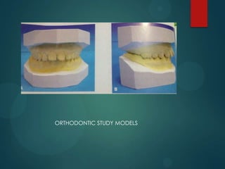 ORTHODONTIC STUDY MODELS
 