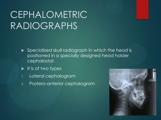 CEPHALOMETRIC
RADIOGRAPHS
 Specialized skull radiograph in which the head is
positioned in a specially designed head holder
cephalostat.
 It is of two types
1. Lateral cephalogram
2. Postero-anterior cephalogram
 