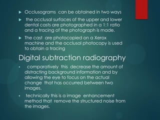  Laser holography
 Holography is photographic technique for
recording and reconstructing images in such
way that 3d aspe...