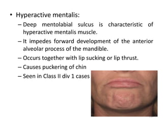 • Hyperactive mentalis:
– Deep mentolabial sulcus is characteristic of
hyperactive mentalis muscle.
– It impedes forward development of the anterior
alveolar process of the mandible.
– Occurs together with lip sucking or lip thrust.
– Causes puckering of chin
– Seen in Class II div 1 cases
110
 
