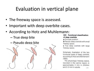 Evaluation in vertical plane
• The freeway space is assessed.
• Important with deep overbite cases.
• According to Hotz and Muhlemann:
– True deep bite
– Pseudo deep bite
128
 