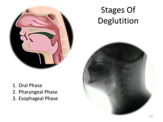 Stages Of
Deglutition
1. Oral Phase
2. Pharyngeal Phase
3. Esophageal Phase
141
 
