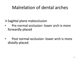 Malrelation of dental arches
Sagittal plane malocclusion
• Pre normal occlusion- lower arch is more
forwardly placed
• Post normal occlusion- lower arch is more
distally placed.
163
 