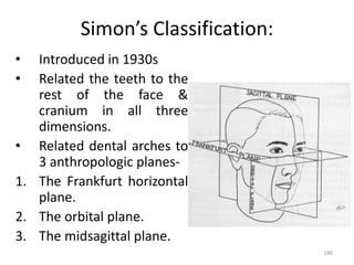 186
Simon’s Classification:
• Introduced in 1930s
• Related the teeth to the
rest of the face &
cranium in all three
dimensions.
• Related dental arches to
3 anthropologic planes-
1. The Frankfurt horizontal
plane.
2. The orbital plane.
3. The midsagittal plane.
 