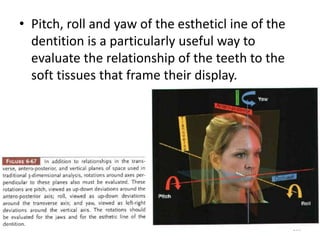 • Pitch, roll and yaw of the estheticl ine of the
dentition is a particularly useful way to
evaluate the relationship of the teeth to the
soft tissues that frame their display.
199
 