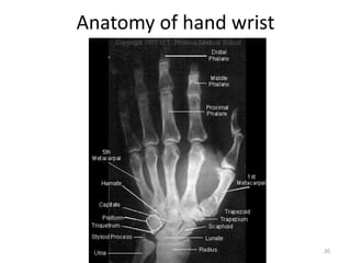 Anatomy of hand wrist
20
 