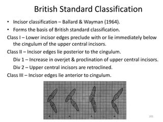 205
British Standard Classification
• Incisor classification – Ballard & Wayman (1964).
• Forms the basis of British standard classification.
Class I – Lower incisor edges preclude with or lie immediately below
the cingulum of the upper central incisors.
Class II – Incisor edges lie posterior to the cingulum.
Div 1 – Increase in overjet & proclination of upper central incisors.
Div 2 – Upper central incisors are retroclined.
Class III – Incisor edges lie anterior to cingulum.
 