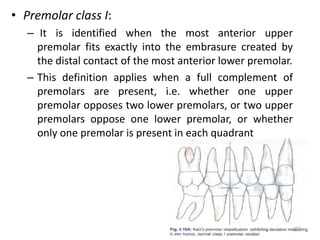 • Premolar class I:
– It is identified when the most anterior upper
premolar fits exactly into the embrasure created by
the distal contact of the most anterior lower premolar.
– This definition applies when a full complement of
premolars are present, i.e. whether one upper
premolar opposes two lower premolars, or two upper
premolars oppose one lower premolar, or whether
only one premolar is present in each quadrant
207
 