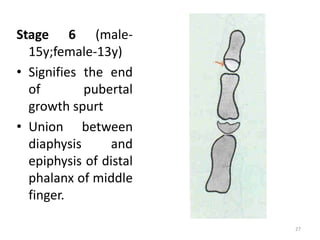 Stage 6 (male-
15y;female-13y)
• Signifies the end
of pubertal
growth spurt
• Union between
diaphysis and
epiphysis of distal
phalanx of middle
finger.
27
 