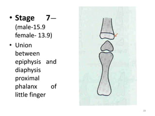 • Stage 7—
(male-15.9
female- 13.9)
• Union
between
epiphysis and
diaphysis
proximal
phalanx of
little finger
28
 