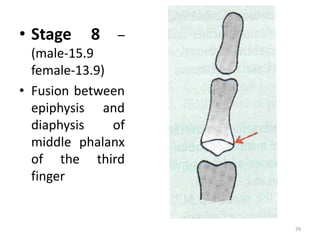 • Stage 8 –
(male-15.9
female-13.9)
• Fusion between
epiphysis and
diaphysis of
middle phalanx
of the third
finger
29
 