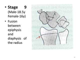• Stage 9
(Male-18.5y
Female-16y)
• Fusion
between
epiphysis
and
diaphysis of
the radius
30
 