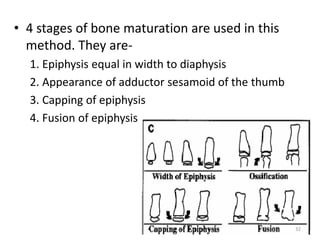 • 4 stages of bone maturation are used in this
method. They are-
1. Epiphysis equal in width to diaphysis
2. Appearance of adductor sesamoid of the thumb
3. Capping of epiphysis
4. Fusion of epiphysis
32
 