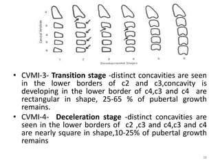 • CVMI-3- Transition stage -distinct concavities are seen
in the lower borders of c2 and c3,concavity is
developing in the lower border of c4,c3 and c4 are
rectangular in shape, 25-65 % of pubertal growth
remains.
• CVMI-4- Deceleration stage -distinct concavities are
seen in the lower borders of c2 ,c3 and c4,c3 and c4
are nearly square in shape,10-25% of pubertal growth
remains
38
 