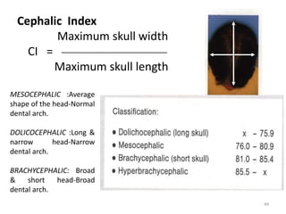 Cephalic Index
Maximum skull width
CI = _________________________
Maximum skull length
MESOCEPHALIC :Average
shape of the head-Normal
dental arch.
DOLICOCEPHALIC :Long &
narrow head-Narrow
dental arch.
BRACHYCEPHALIC: Broad
& short head-Broad
dental arch.
49
 