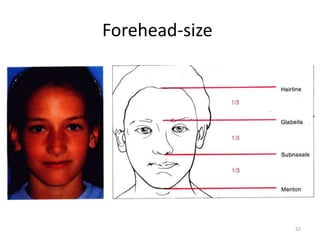 Forehead-size
52
 