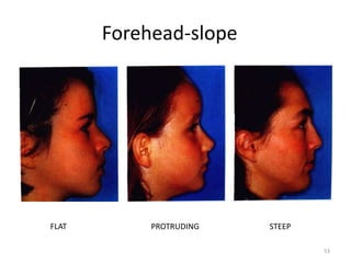 Forehead-slope
FLAT PROTRUDING STEEP
53
 