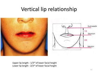 Vertical lip relationship
Upper lip length - 1/3rd of lower facial height
Lower lip length - 2/3rd of lower facial height
57
 