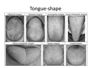 Tongue-shape
63
 