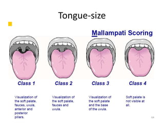 Tongue-size
64
 