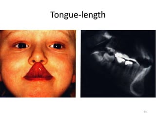 Tongue-length
65
 