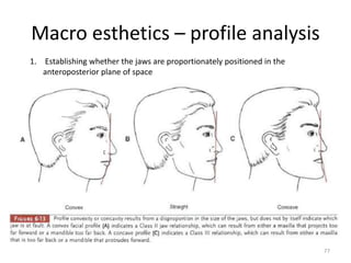 Macro esthetics – profile analysis
1. Establishing whether the jaws are proportionately positioned in the
anteroposterior plane of space
77
 