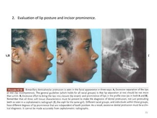 2. Evaluation of lip posture and incisor prominence.
79
 